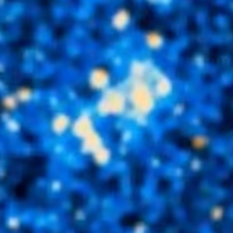 DSS image of NGC 241, an open cluster in the Small Magellanic Cloud